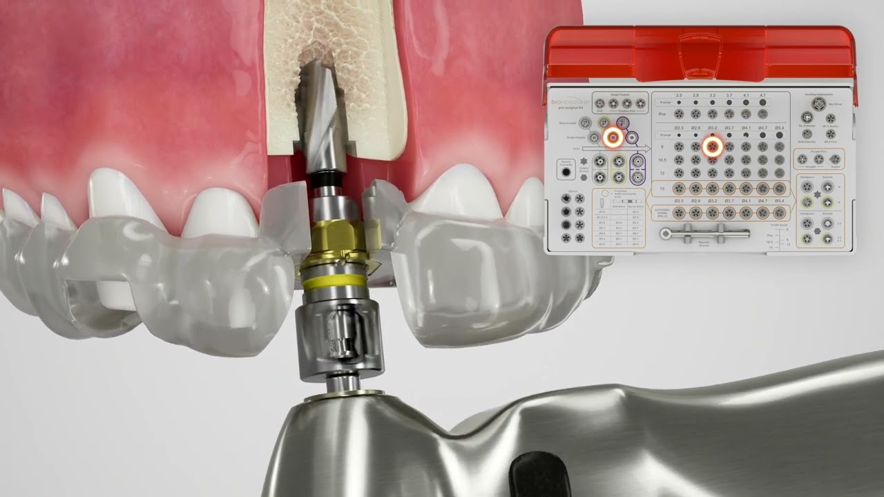 PRO5000 Surgical Kit