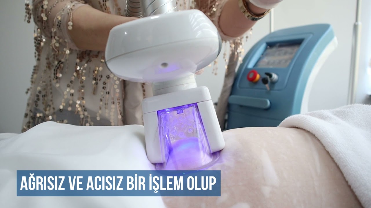 Soğuk Lipoliz