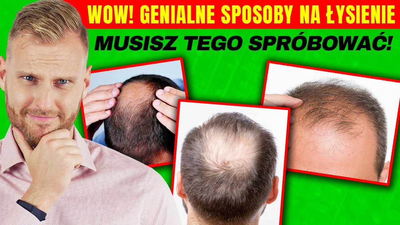 ŁYSIENIE rujnuje ZDROWIE? Jak Cofnąć Wypadanie Włosów i Zakola?