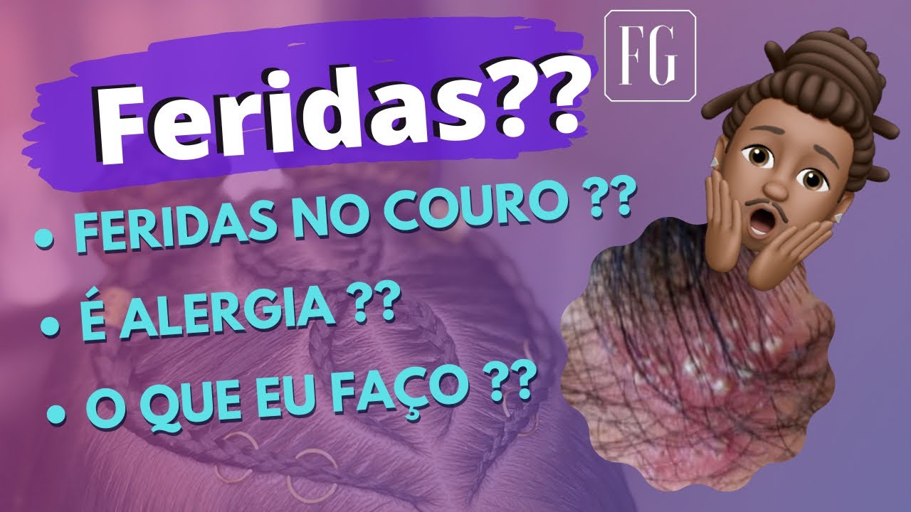 Foliculite Capilar - Feridas no couro ao trançar o cabelo ‼️ •• FG ••