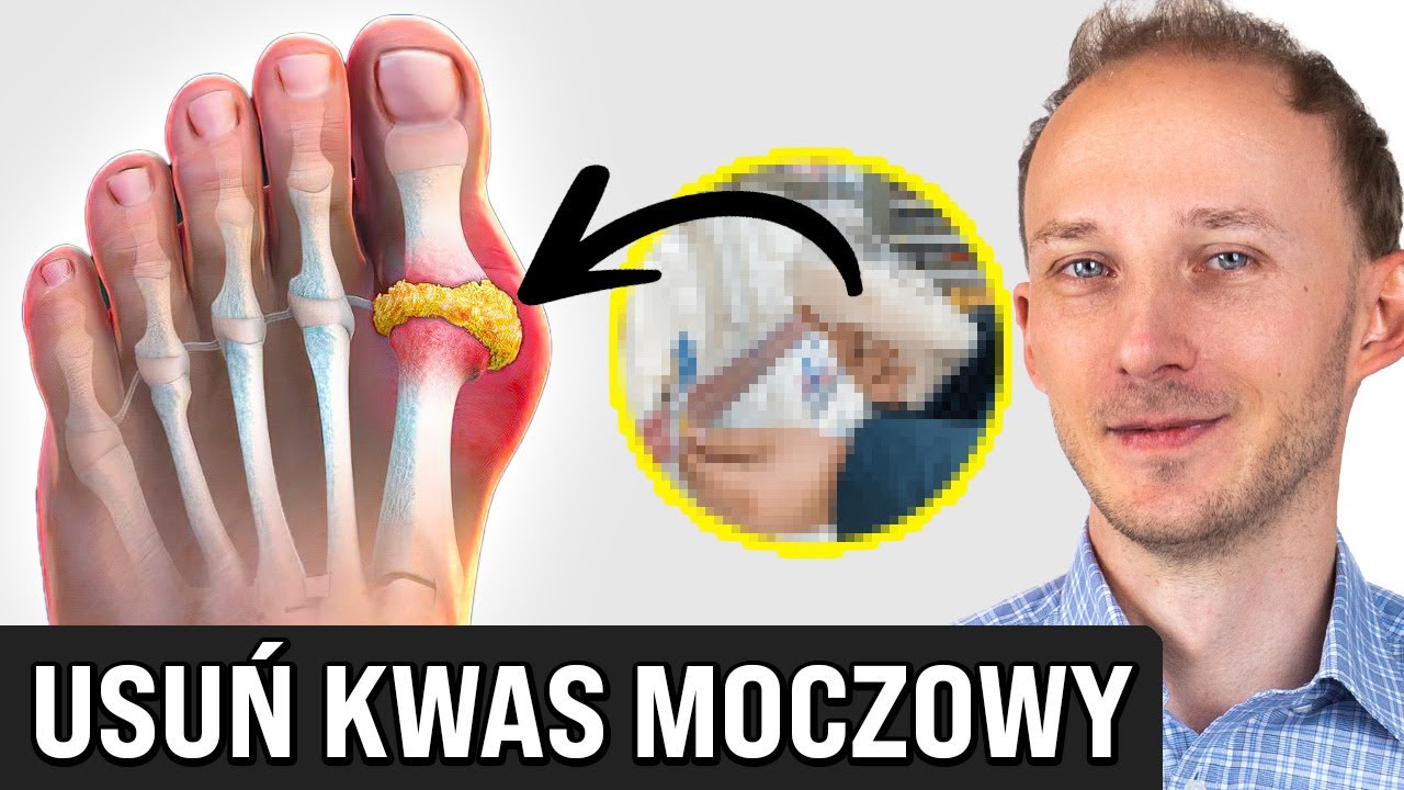 To główna przyczyna wysokiego kwasu moczowego, bólu stawów i dny moczanowej