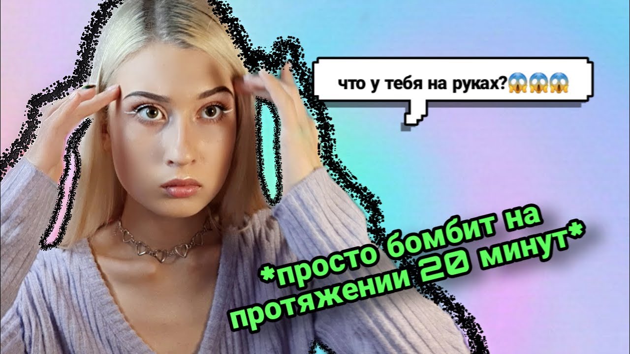 шрамы У МЕНЯ, а ведут себя НЕАДЕКВАТНО они // как люди реагируют на мои руки (истории из жизни)