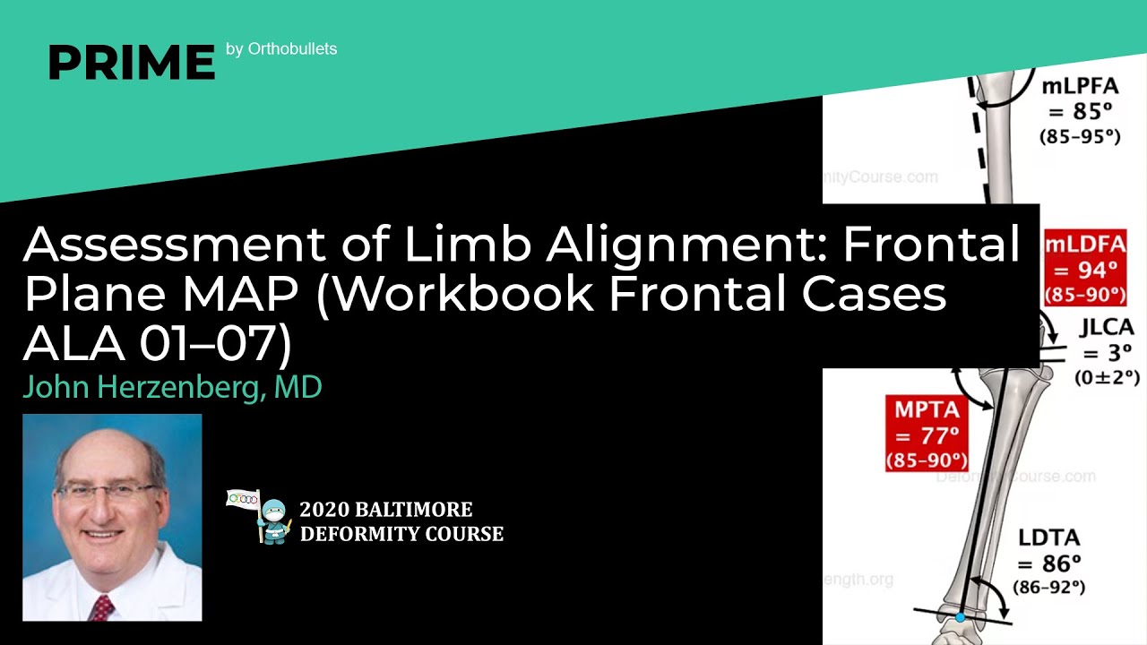 Assessment of Limb Alignment: Frontal Plane MAP (Workbook Cases) - John Herzenberg, MD