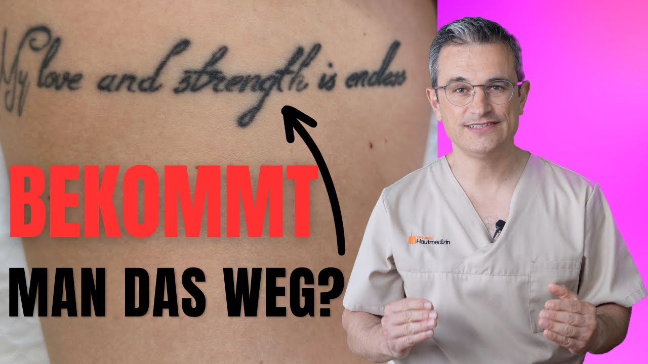 Tattoo entfernen mit Laser: Ablauf, Risiken und Erfahrungen:  Dr. Kasten Hautmedizin Mainz #tattoo