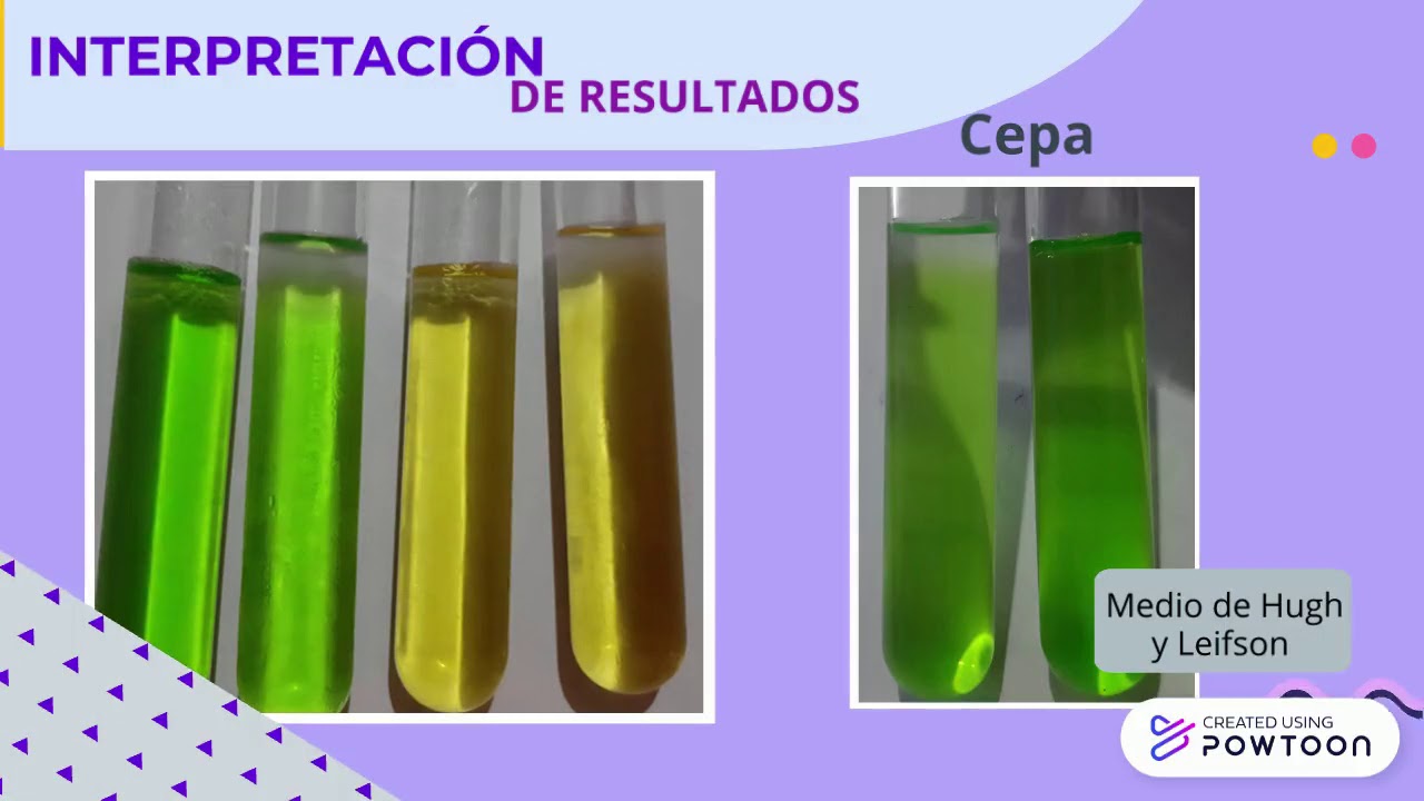 Prueba bioquímica OF (Test de Hugh Leifson)
