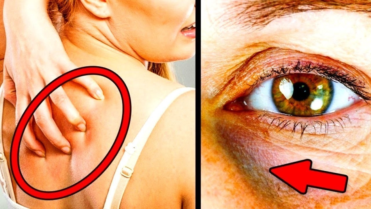 8 Signale deines Körpers, dass du zu viel Zucker isst!