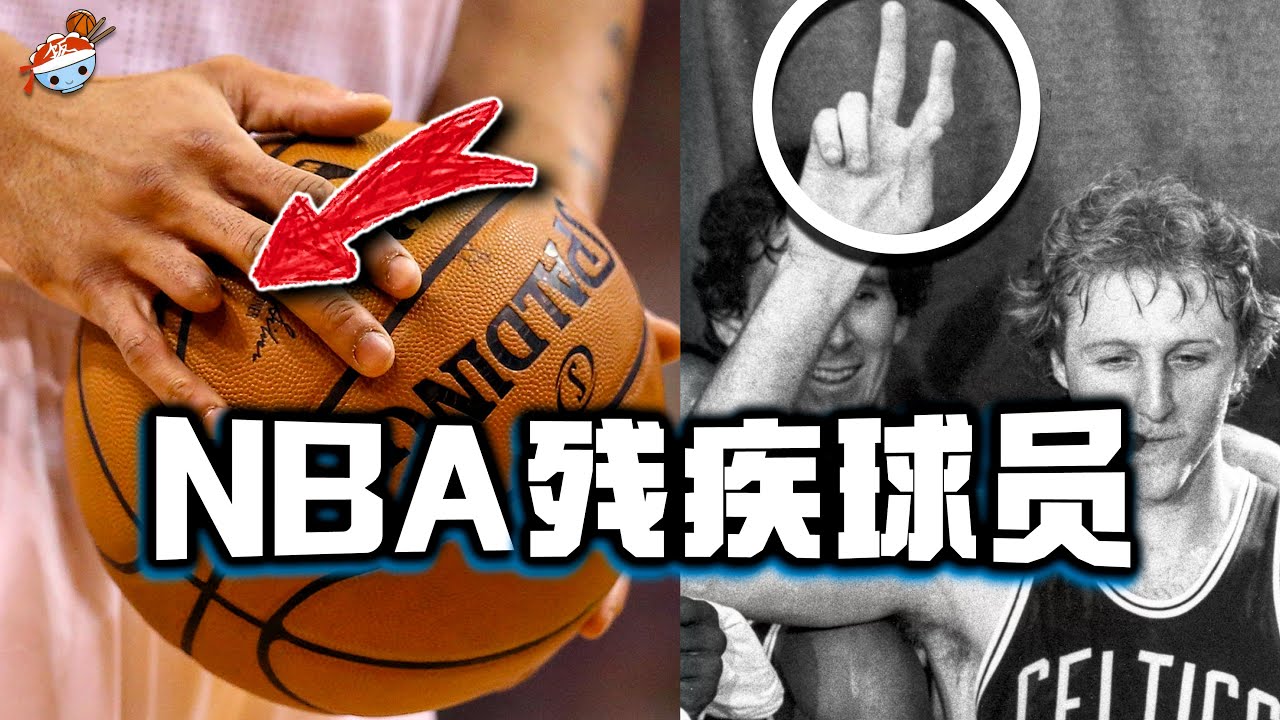 【冷飯說】身體畸形的十大"殘障"人士：NBA歷史前十巨星就有兩人！