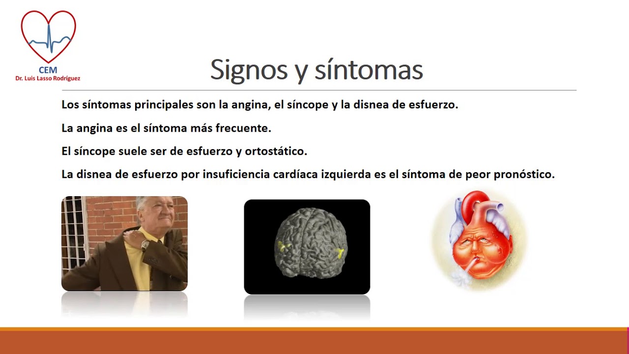 Estenosis Valvular Aórtica