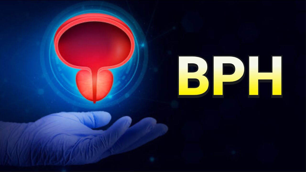 Benign Prostatic Hyperplasia (Enlarged Prostate) - CRASH! Medical Review Series