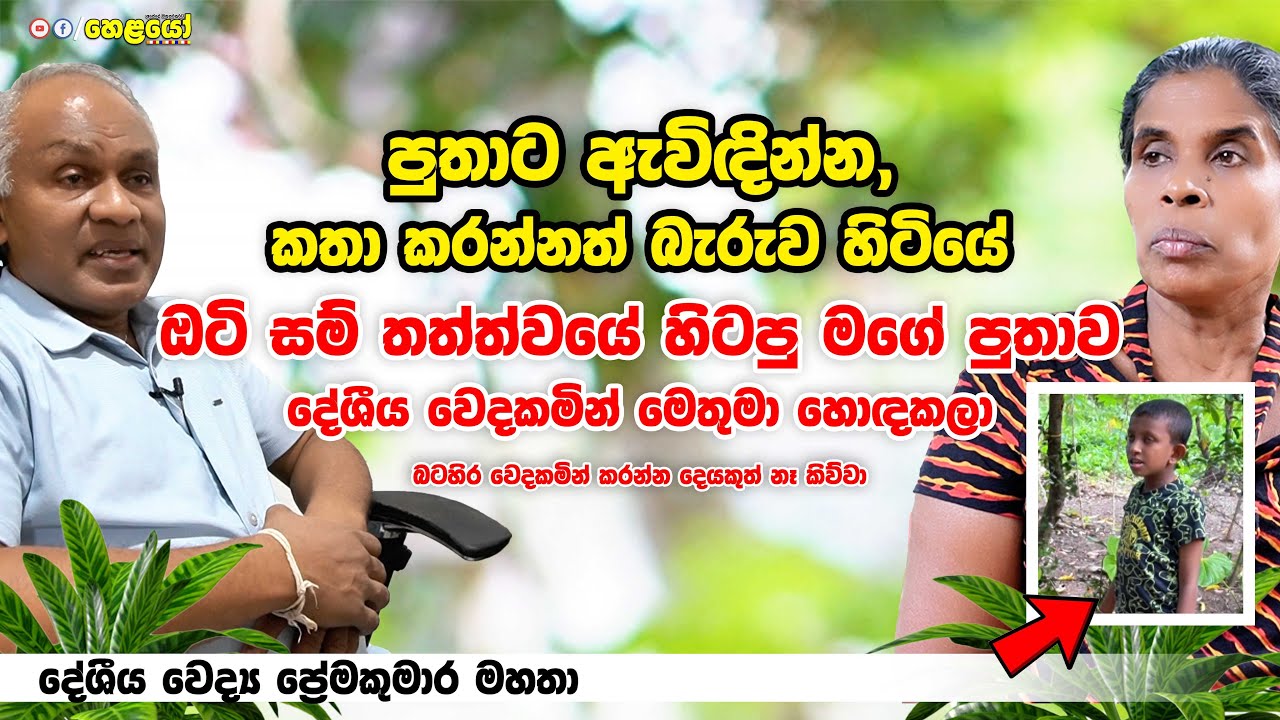 ඔටි සම් තත්ත්වය සුව කල හැකියි -  දේශීය වෛද්‍ය ප්‍රේමකුමාර මහතා