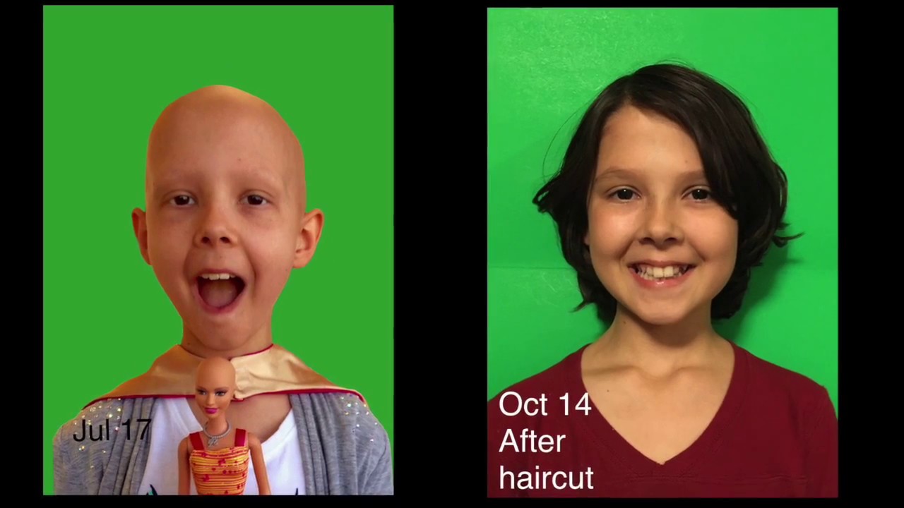 Grace's Hair Growing Back After Chemo Time-lapse