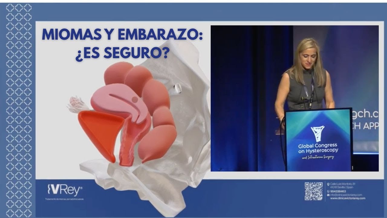 Radiofrecuencia en Miomas: Innovación y Resultados Clínicos (GCH 2025) - Voz en Español.