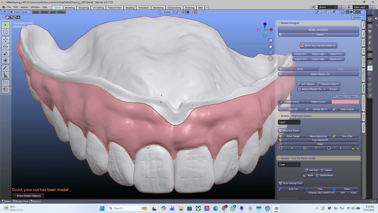 Окно внутри зубного протеза