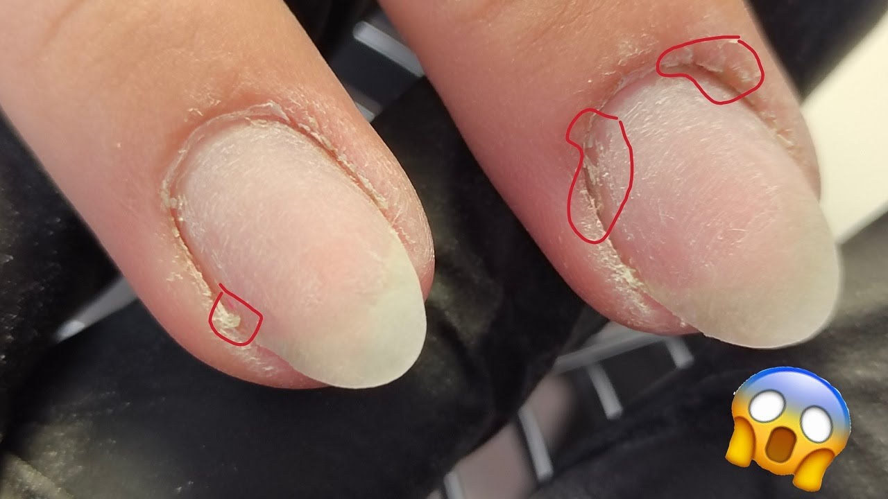 Nail restoration. Wet cuticles. Wet nails. Manicure thin nails.
