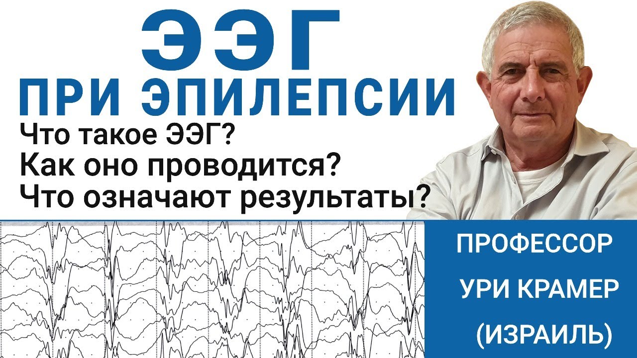 Что такое ЭЭГ? Как делают проверку и что она показывает? Смотрите ответ эксперта