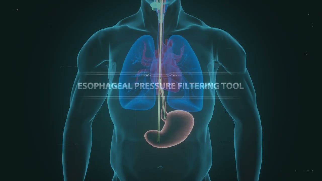 SV800 Auxiliary Pressure Solution Video