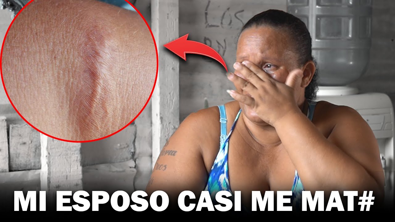 Su esposo caso la Desvive 😱😔 pero ella Vivió para contarlo TESTIMONIO