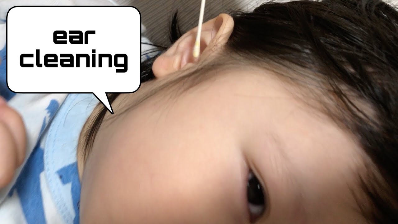 #3🇻🇳2 year old ear cleaning