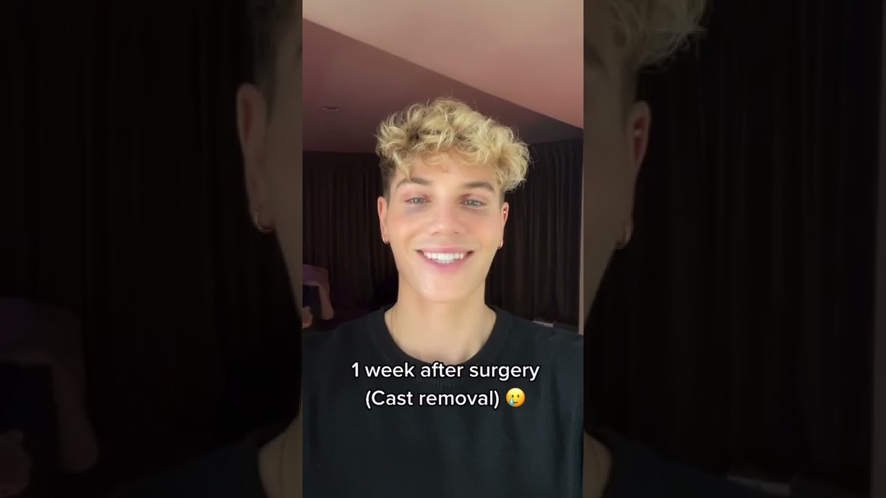 Nicky&rsquo;s nose job recovery! #shorts | Nicky and Pierre #NiPi