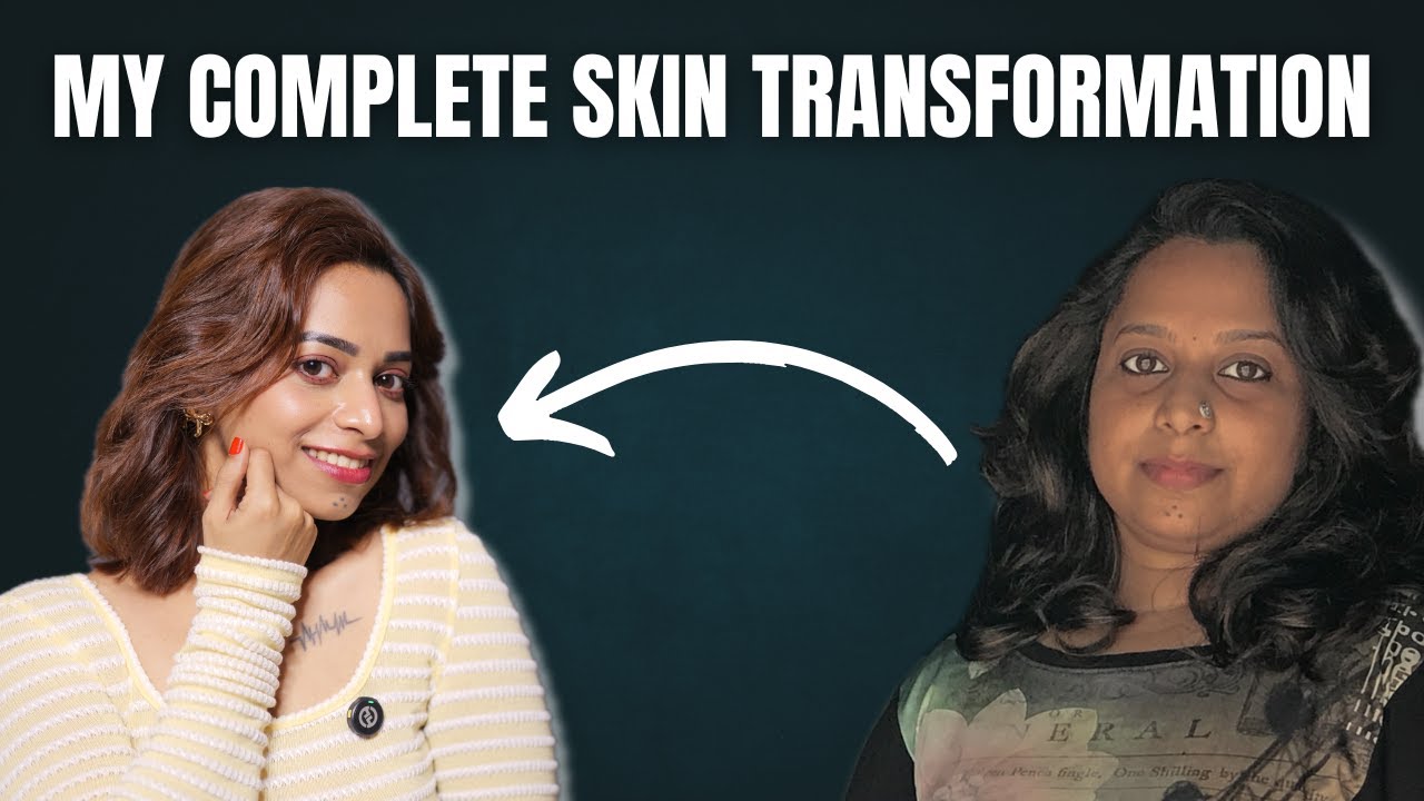 ✨My Skin Transformation |Hyperpigmentation |Dark spots |Tanning |Dull skin| Malayalam| #skincare
