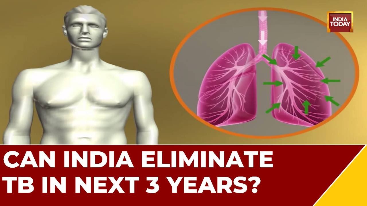 Tuberculosis In India: Road to Elimination |‘Pradhan Mantri TB Mukt Bharat Abhiyaan’ To Eliminate TB