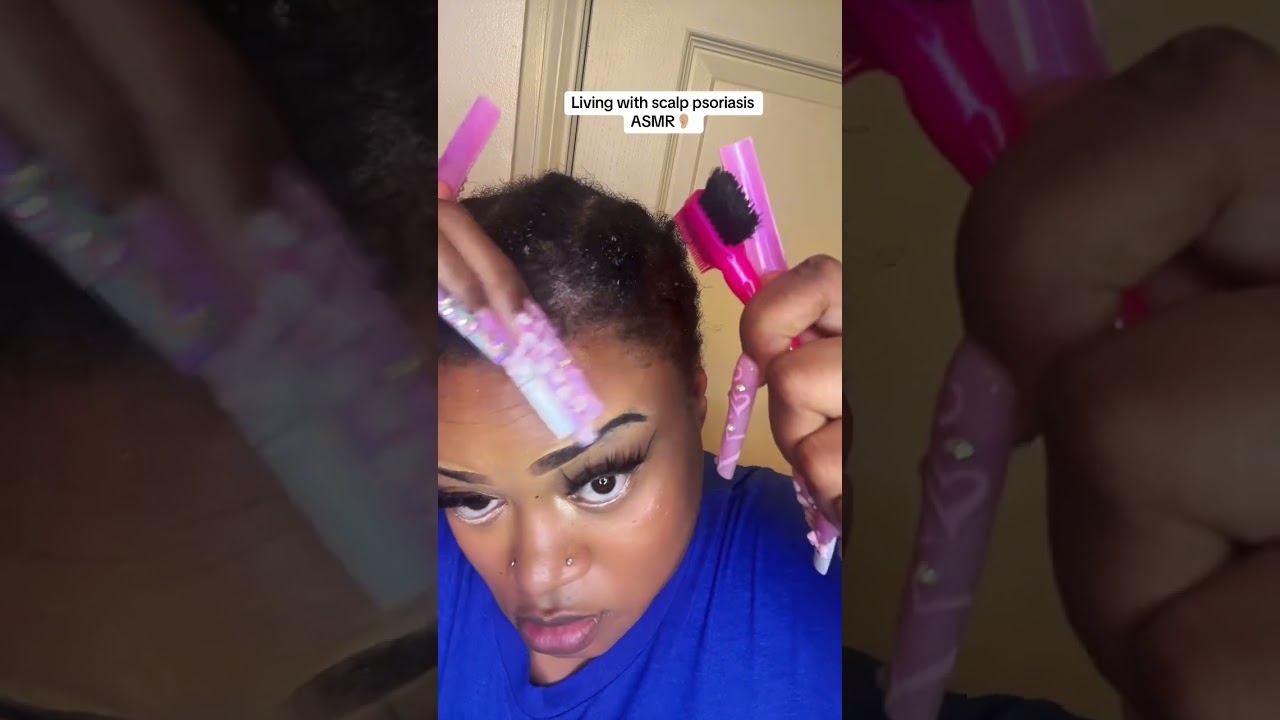Please help my scalp 🙏🏽 #asmr #beauty #viral #youtubeshorts #fypシ 