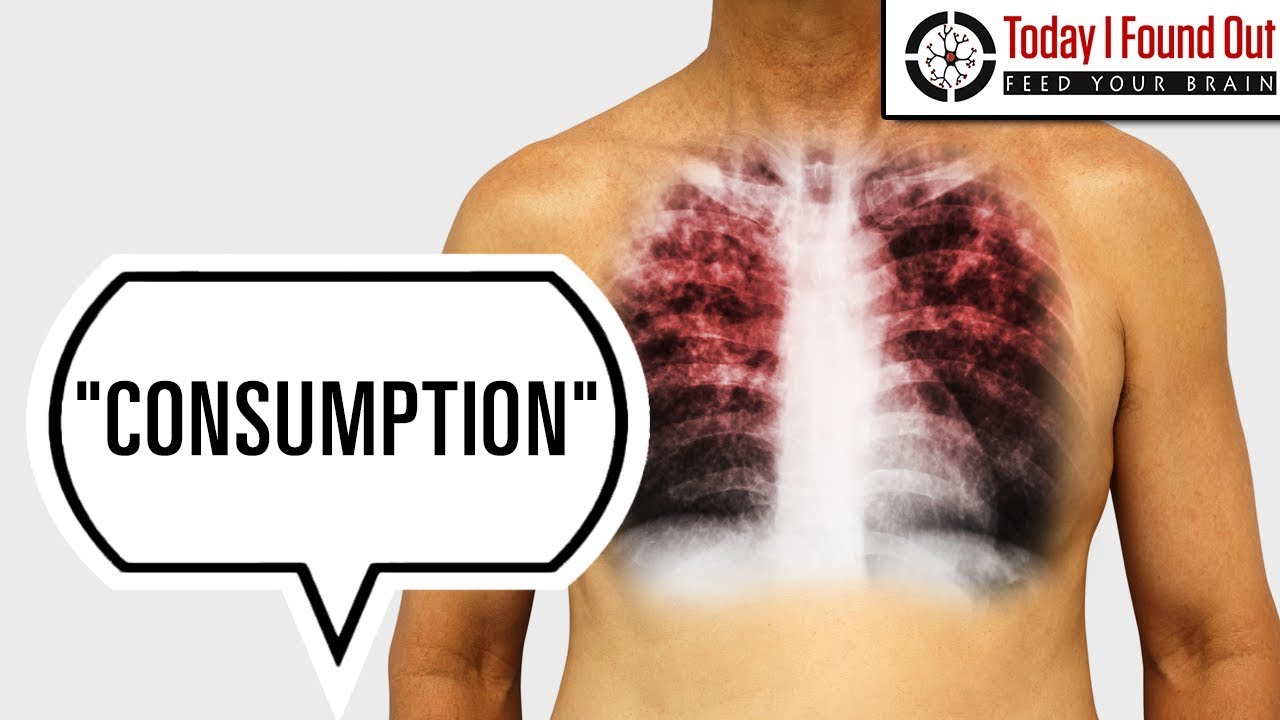Why Was Tuberculosis Called Consumption?