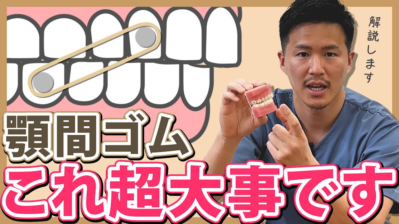 【歯列矯正】顎間ゴムってすごく大事！歯科医師が５分で解説します。