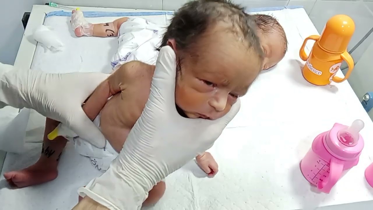 Premature RDS Twins Baby Recovery | Start Feeding Tryle After Critical Condition #NewbornCareJourney