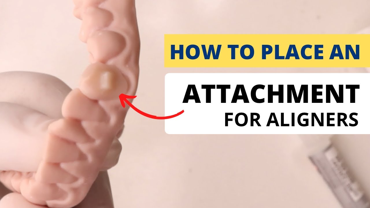 HOW TO PLACE AN ATTACHMENT (for Aligners)