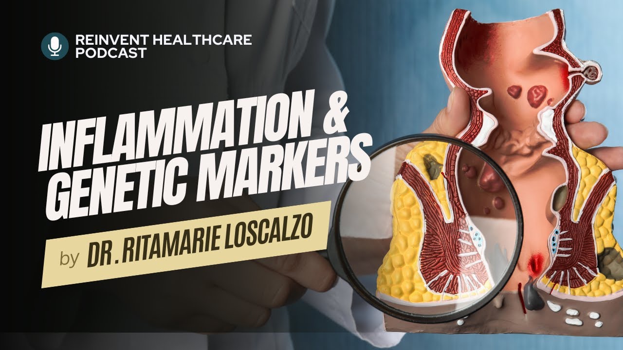 Dealing with Inflammation and Autoimmune Diseases with Advanced Genetic Testing