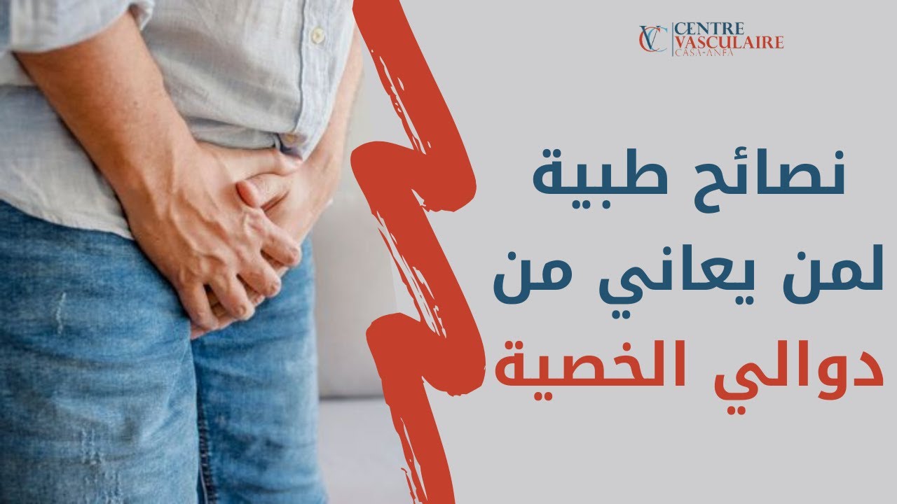 ما هي نصائح الطبيب لمن يعاني من دوالي الخصية؟