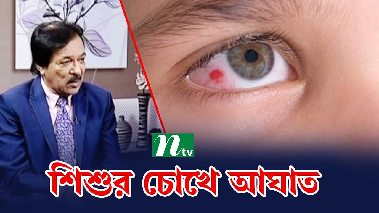 শিশু চোখে আঘাত পেলে কী করবেন। Health Show | স্বাস্থ্য প্রতিদিন |