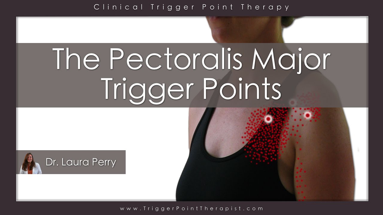 The Pectoralis Major Trigger Points