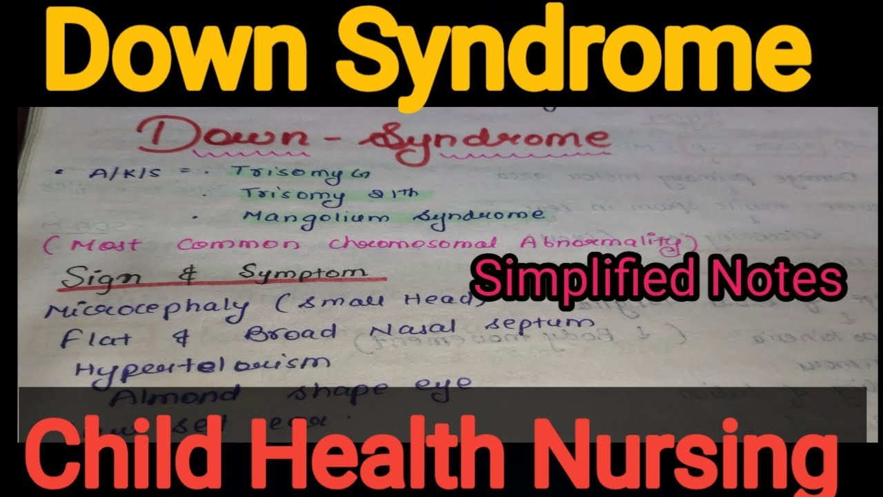 Notes of Down Syndrome in Child Health Nursing (Pediatrics) in Hindi /Bsc Nursing