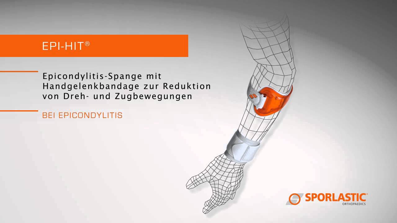 SCHNELLE HILFE: VERSORGUNGSLÖSUNGEN FÜR DEN ELLENBOGEN