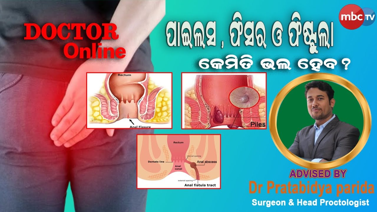 DOCTOR ONLINE | How to Cure Piles, Fissure & Fistula | Dr Pratabidya Parida | 25th Aug 2024 | MBCTv