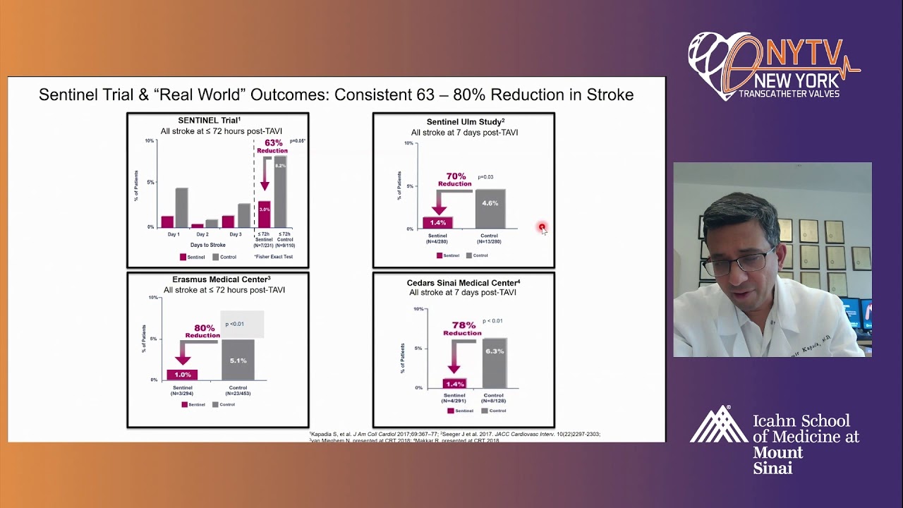 Neuro-Protection in TAVR: Is it Effective? - Samir Kapadia, MD