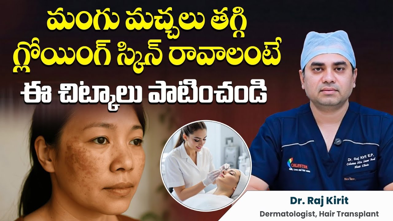 ముఖం మీద మంగు మచ్చలు పోవాలంటే ఏం చేయాలి? | Best Treatment for Melasma on Face | Celestee Clinic