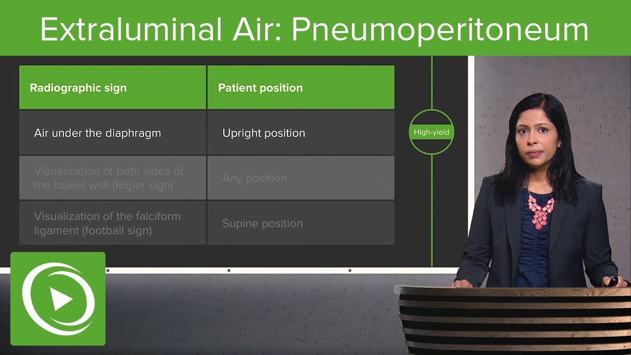 Extraluminal Air: Pneumoperitoneum & Pneumoretroperitoneum – Radiology | Lecturio