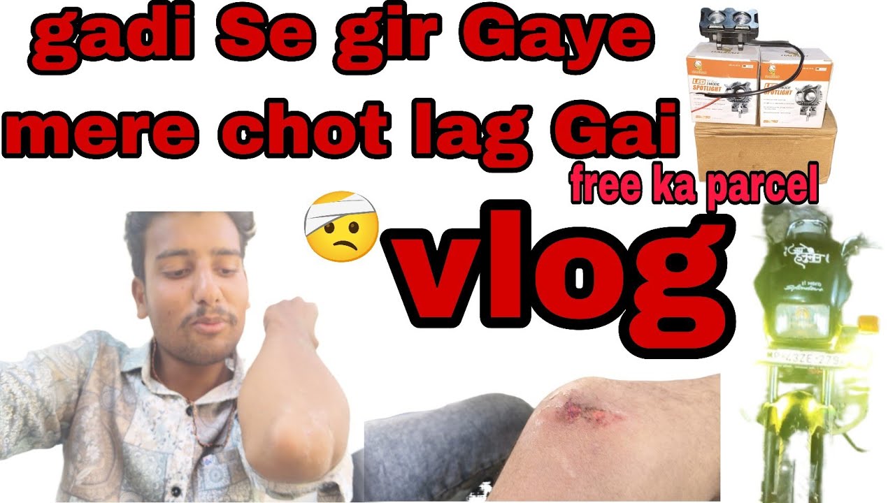 Gadi Se gir Gaye mere chot lag Gai#vlog 