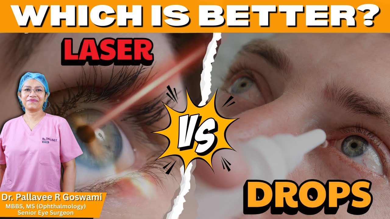 Laser Treatment for Glaucoma or Drops: Which is Better in 2025?