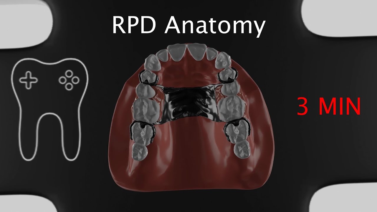 RPD components and function in 3 mins