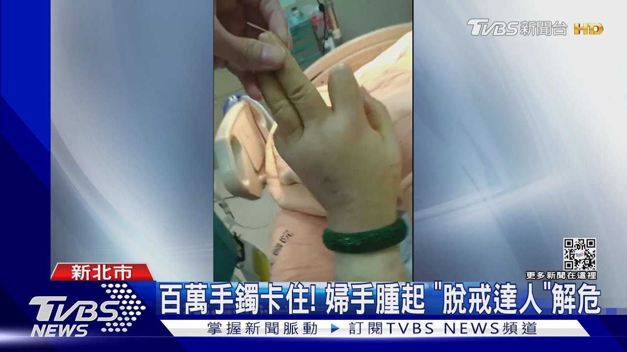 百萬手鐲卡住! 婦手腫起 「脫戒達人」解危｜TVBS新聞  @TVBSNEWS01