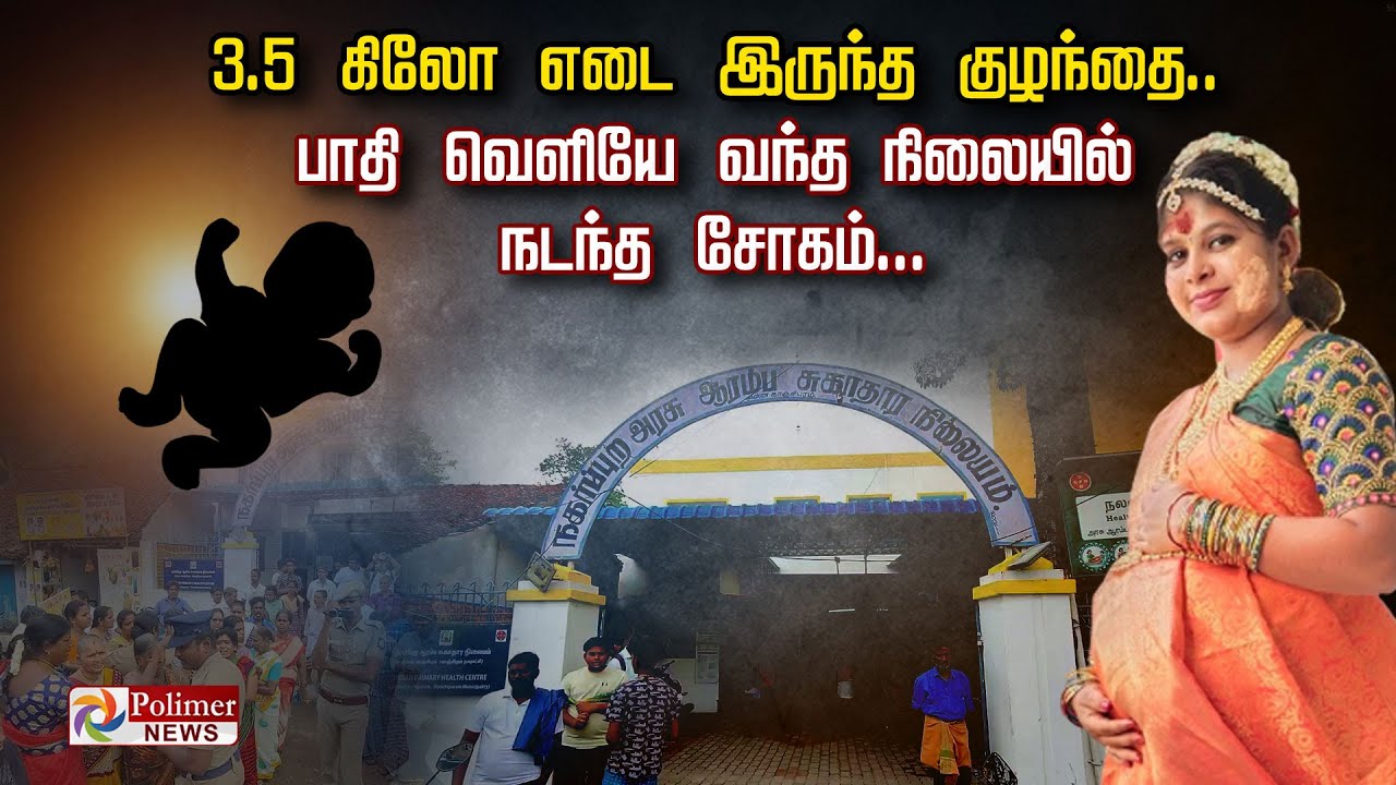 3.5  கிலோ எடை இருந்த குழந்தை... பாதி வெளியே வந்த நிலையில் நடந்த சோகம்..!