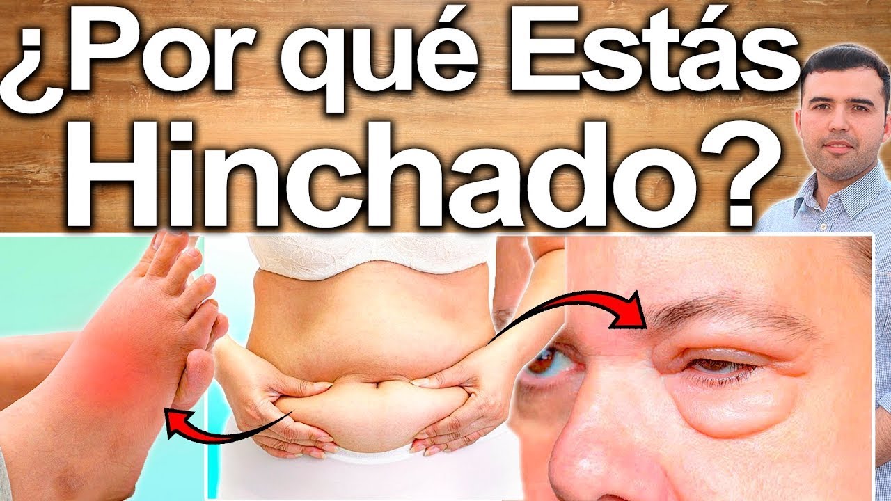 Porqu&eacute; Estoy Hinchado? - Causas Y Soluciones Para Eliminar El Exceso L&iacute;quido - Alimentos Diur&eacute;ticos