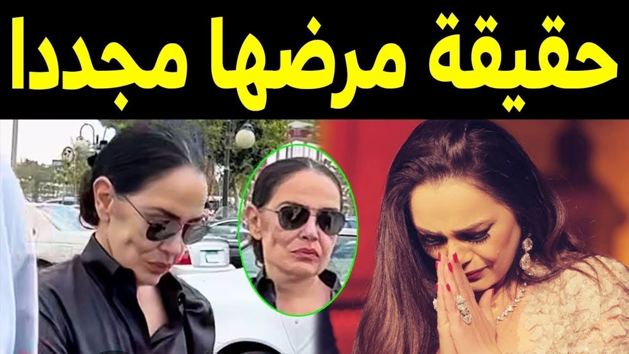 السـرطان يصيب الفنانه شريهان مجددا .. شاهد التشوه الكبير الذي تركه في خدّها رغم عمليات التجميل