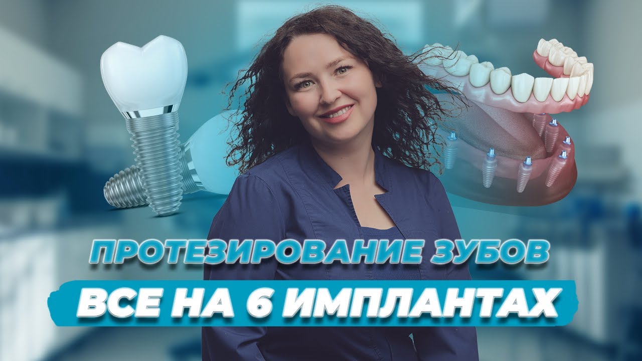 Нет зубов? Все зубы разрушены? Все об имплантации 