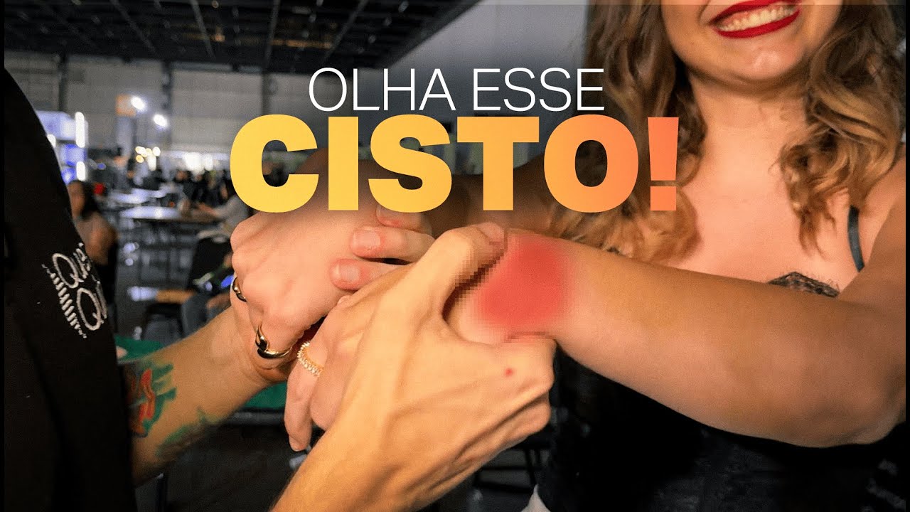 TRATAMOS O CISTO DELA COM QUIROPRAXIA