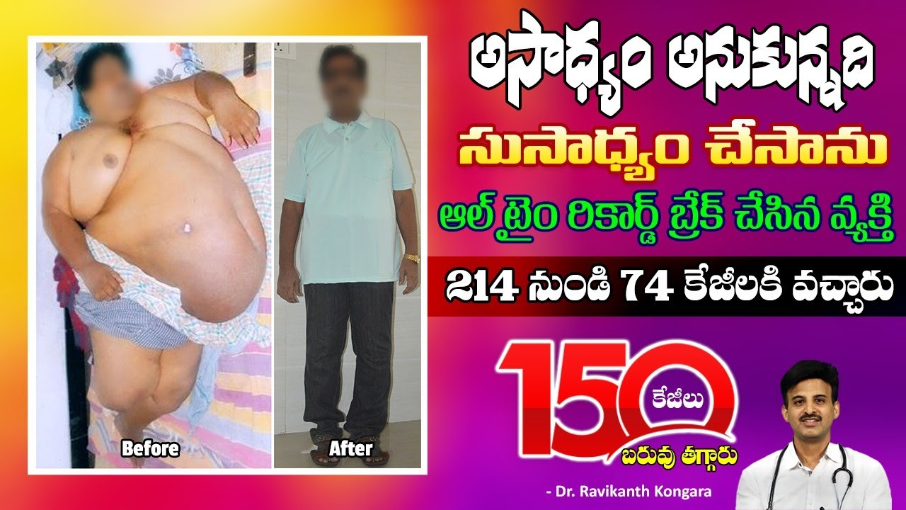 Patient Weight Loss Story | 215 kgs to 150 kgs Weight Loss | Pandari Nadh | Dr. Ravikanth Kongara